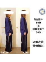 RKY/美容整体&頭蓋骨矯正☆