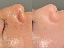 ルーナジェーナ(Luna llena)/