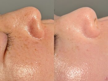 ルーナジェーナ(Luna llena)/