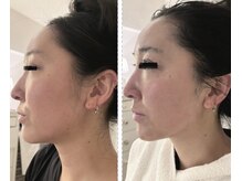 カティエ 表参道(Katie.)/表参道　エンビロン