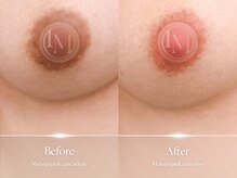 ジジベレッザ 芦屋店(jiji belleza)の雰囲気（今大人気の韓国シェアNo1黒ずみ“ルメラ”認定サロン/梅田）