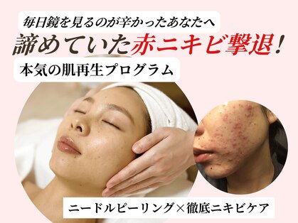 アロマ(AROMA)の写真