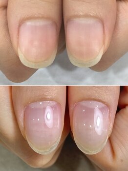 リファーレ(RIFARE)/ハイポニキウムが伸びた!