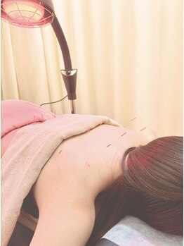 いさはや鍼灸整骨院の写真/『整体×鍼灸』であなただけの特別な施術をご提供◇身体のことを知り尽くしたプロが徹底サポート◎