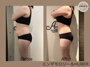 アムール 麻布十番(Amour)/エンダモロジ-アライアンス