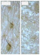 トランク(Trunk)/ハイドラ♪before→after