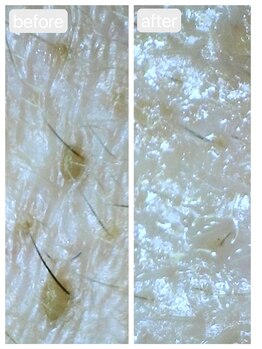 トランク(Trunk)/ハイドラ♪before→after