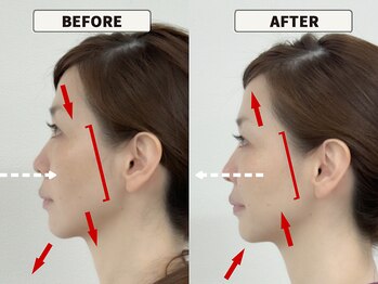 さつま骨格矯正 渋谷 恵比寿本院/即効性抜群のハイパワー電ボト