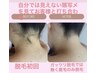 女性　うなじ脱毛　カウンセリング込み¥4000→¥3800