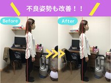 京都中丸整体カイロプラクティック/不良姿勢