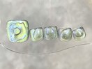 涼しげグリーンマグネット