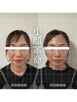 ザ リフト カドモリ 鹿児島 霧島(The Lift KADOMORI)/Before→After