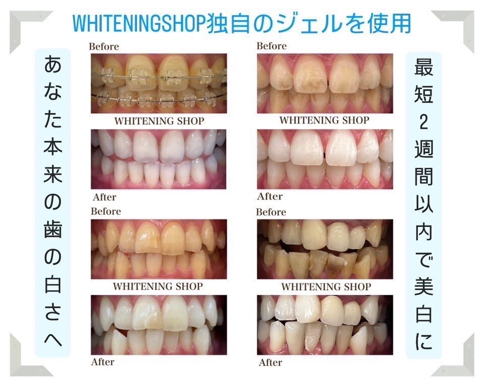 ホワイトニングショップ 山科店｜ホットペッパービューティー