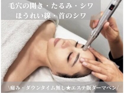 ジェリー(JERRY)の写真