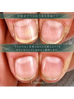 エッセンス (Essence)の写真/綿密なカウンセリングで噛み爪や深爪も状態に合わせたケアで改善。美爪育成で指先に自信を持ちたい方にも。