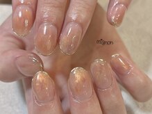 ミニョン(mignon)/mignon定額コース