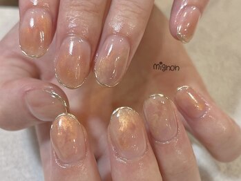 ミニョン(mignon)/mignon定額コース
