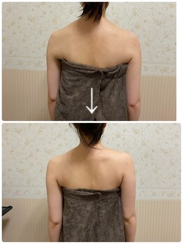 エステティックサロン ベルエトワール住吉店/肩甲骨バストアップマッサージ