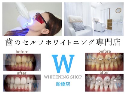 ホワイトニングショップ 船橋店の写真