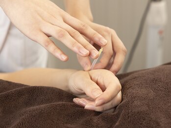 ブレア 銀座/施術写真【自律神経/虎ノ門/鍼】