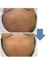 レベンディス(LEVENDIS)/エイジンクケア★ハーブ