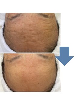 レベンディス(LEVENDIS)/エイジンクケア★ハーブ