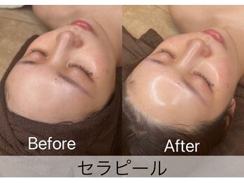 マドモアゼル 麻布十番/NEW！！セラピール