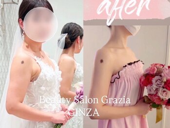 グラツィア 銀座(Grazia)/6回【 ブライダルエステ整体 】