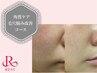 【ツヤ肌・毛穴ケアコース】REVIハーブピーリング全顔　¥16,500→￥11,000