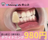 ホワイトニングカフェ 郡山店