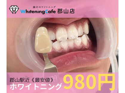 ホワイトニングカフェ 郡山店の写真