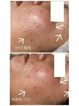 スリリアン 銀座/★お客さまビフォーアフター★