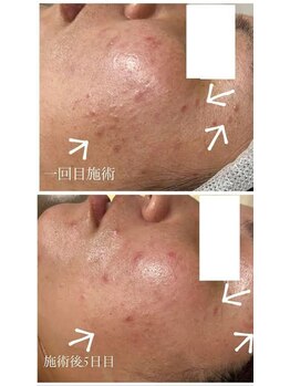 スリリアン 銀座/★お客さまビフォーアフター★