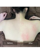 トニック バイ まつもと整骨院鍼灸院(Tonic)/★Before After★豊中／肩こり