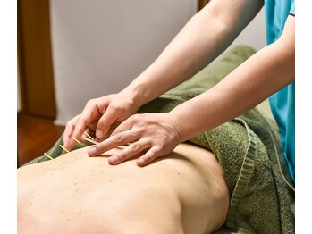 金町5丁目鍼灸マッサージ院/鍼灸施術の様子