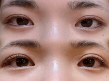 アイラッシュバーリー バイ ノブグループ(EYE LASH BARLEY by NOB GROUP)/