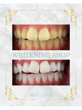 ホワイトニングショップ 三ノ宮店/【お客様のビフォーアフター】