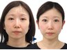 [小顔]も[リフトUP] も諦めたくない方★頭から引上げ【小顔矯正+頭蓋骨矯正】