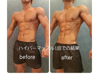 アンレーヴ/ハイパーマッスル