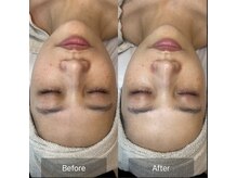 ルミナス(Luminous)/ララピール