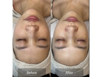 ルミナス(Luminous)/ララピール