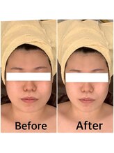 スペチアーレ 夙川/