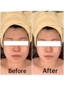 スペチアーレ 夙川/