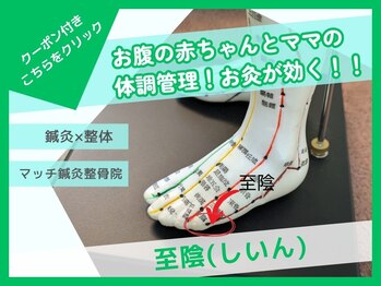 マッチ鍼灸整骨院/至陰の灸、お腹の赤ちゃんの為に