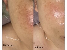 プアラ(puala)/シェービング