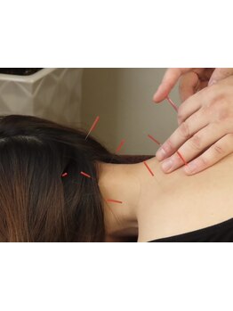 首・肩のつらさを改善したい