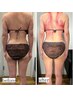 【初回限定】ハイパーナイフ×筋膜リリース　全身集中DETOX  90分　9,900円