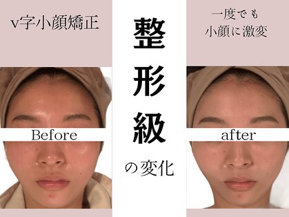 ポラリス(Polaris)の写真