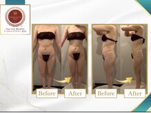 気持ち良く効果をご実感頂けるマシンとハンドの熟練した施術。