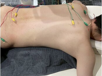 ザワ鍼灸接骨院(zawa鍼灸接骨院)の写真/【鍼灸・美容鍼が初めての方におすすめ】丁寧なカウンセリングで体調やお悩みをお伺いいたします◎